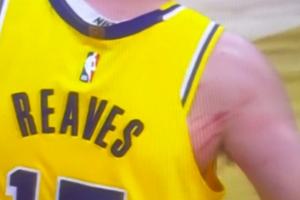 猛龙主帅说里夫斯哨子多？里夫斯后背&手臂已被挠出“兽痕”