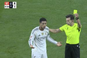 没给牌！贝林头部遭肘到出血，之后反因未经允许入场染黄